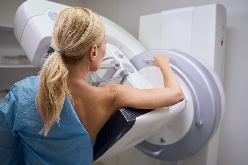 ABC 3d mammography and 3D Tomosynthesis